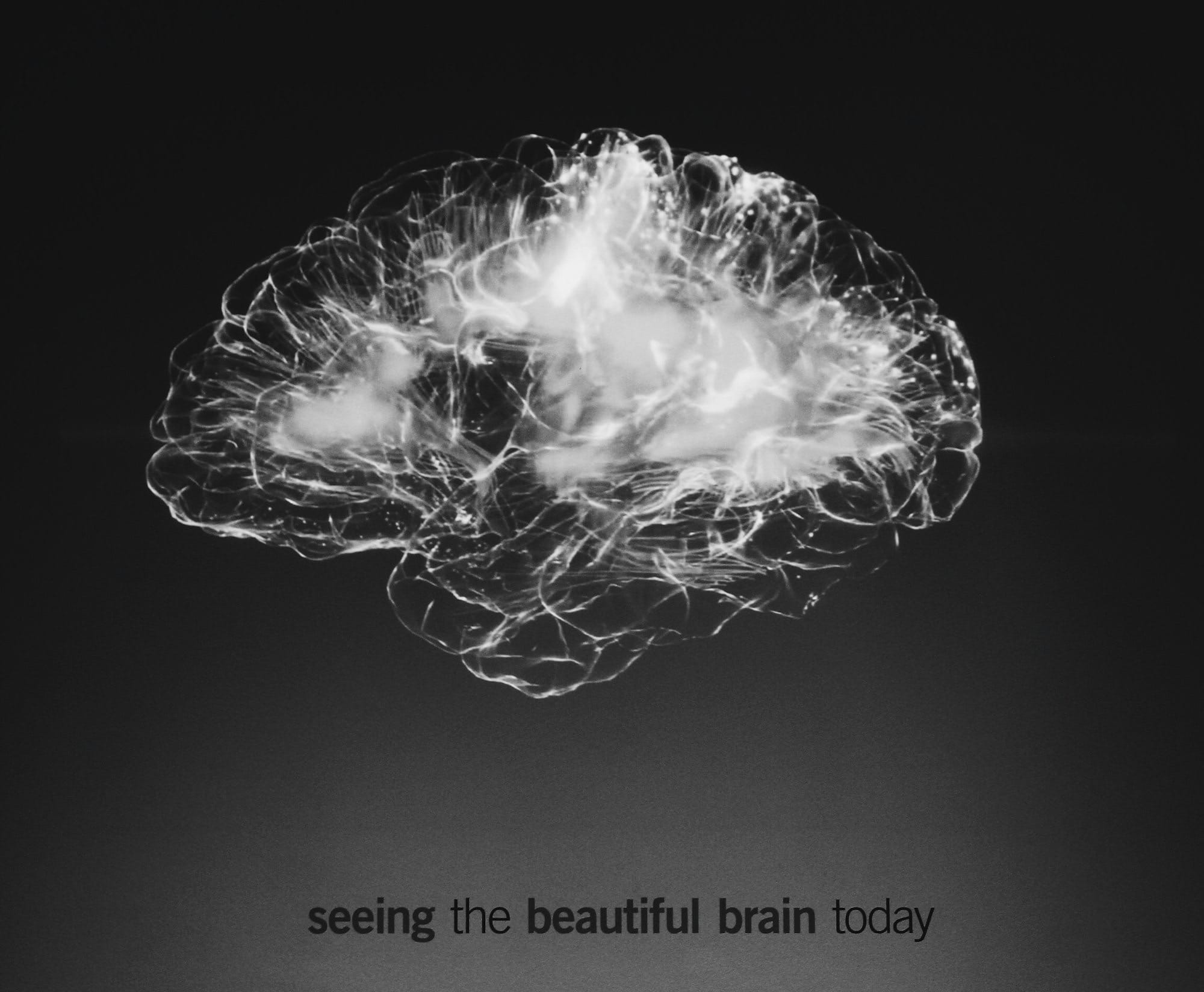 a black and white photo of a brain